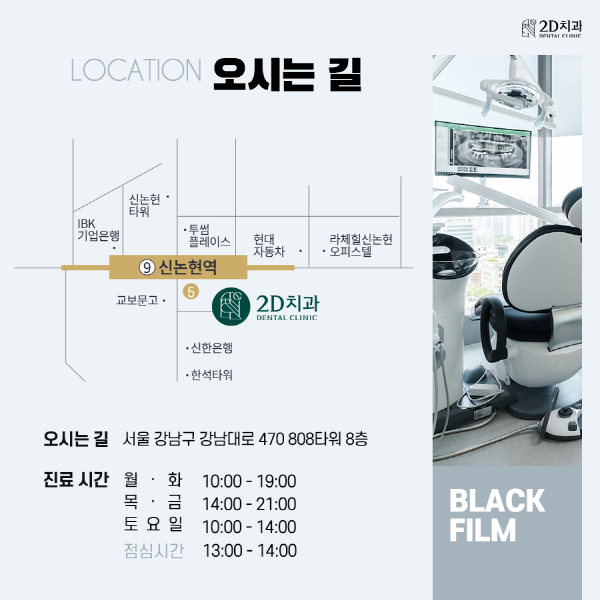 "이건 몰랐지?" 프리미엄 앞니 라미네이트 <블랙필름> 관련 이미지 8