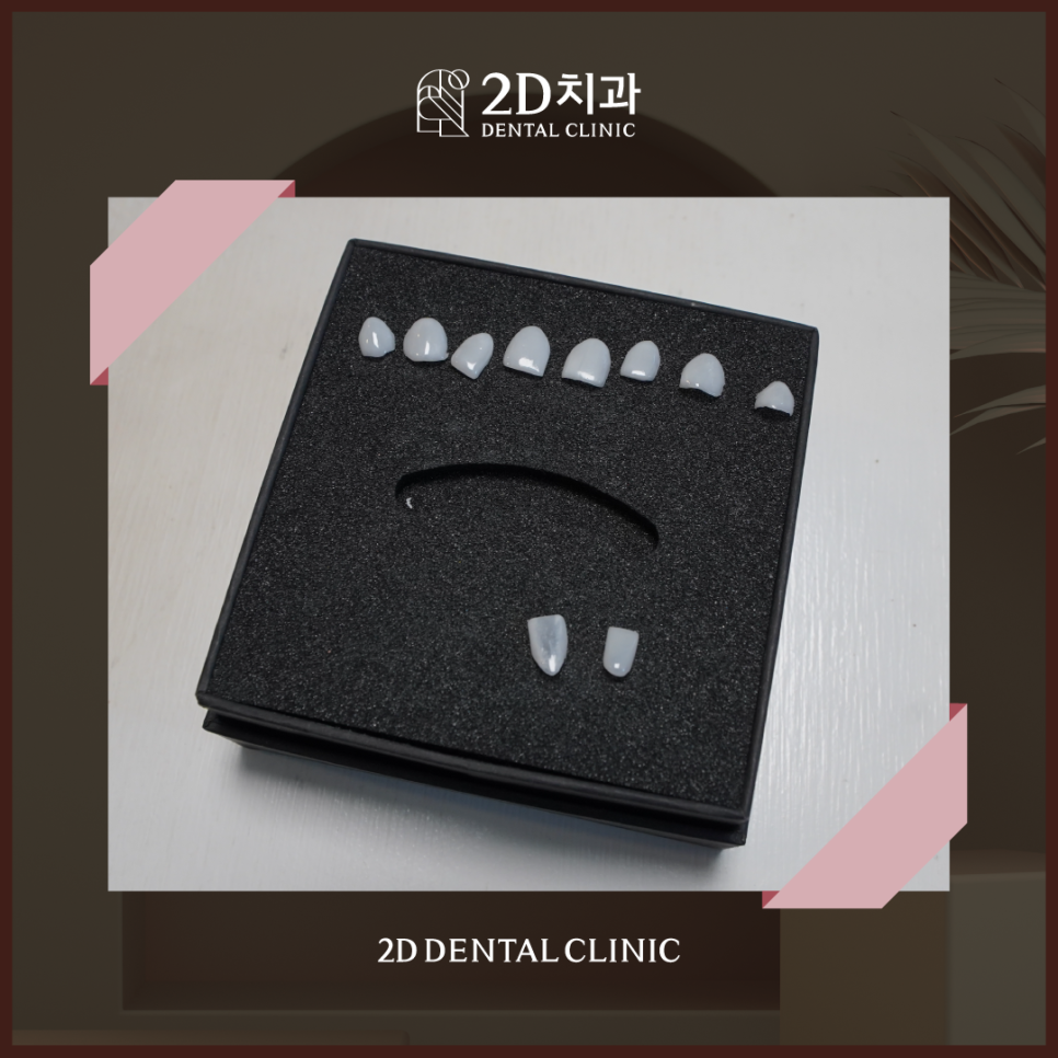 라미네이트제거 치아시림 튼튼한 상태로 유지할 수 있도록 관련 이미지 2