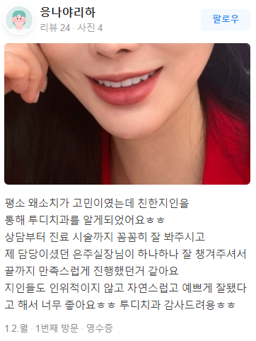연예인라미네이트 어디가 잘할까? 관련 이미지 11