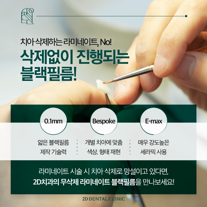 라미네이트무삭제 치아깨짐에도 자연스럽게 관련 이미지 4