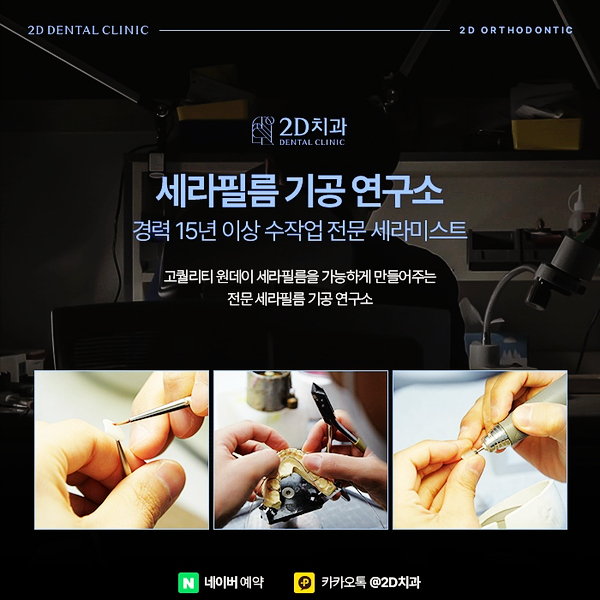 티안나는교정 찾는다면 논현동치과에서 투명교정가격 따져보세요. 관련 이미지 6