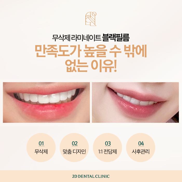 수작업 블랙필름 무삭제라미네이트가격과 장점 관련 이미지 3