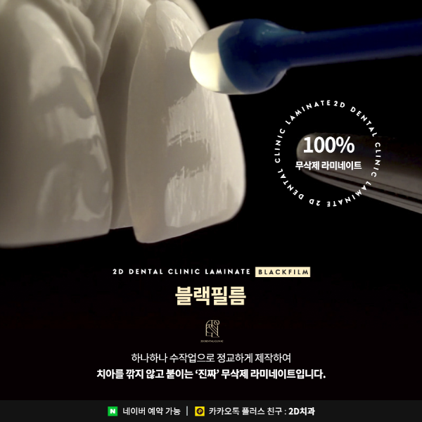 "깨진 앞니 방치하면 안 돼요!" 2D치과 맞춤 치료법 관련 이미지 6