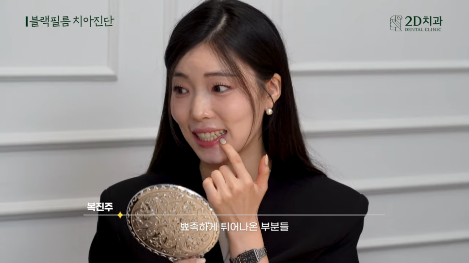 치과상담 앞니라미네이트 교정 치아에도 블랙필름 가능한가요? 관련 이미지 11