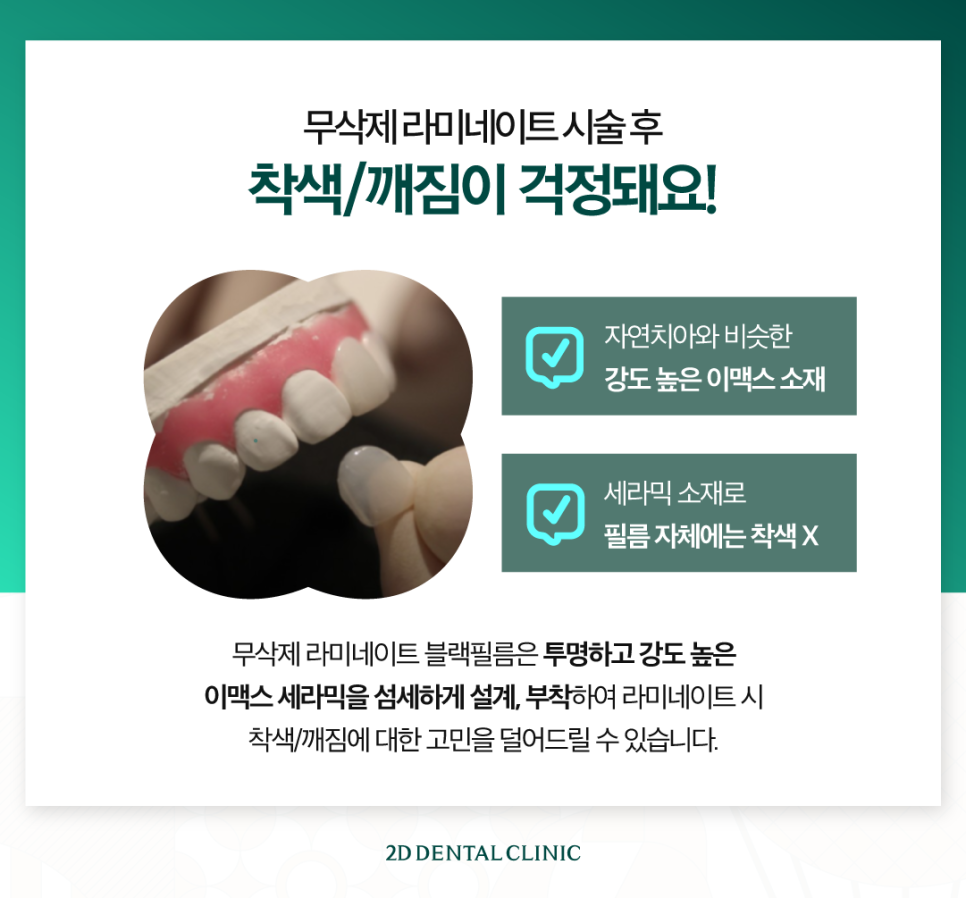 무삭제라미네이트부작용 치아부분변색 얼룩진 앞니 개선 관련 이미지 4