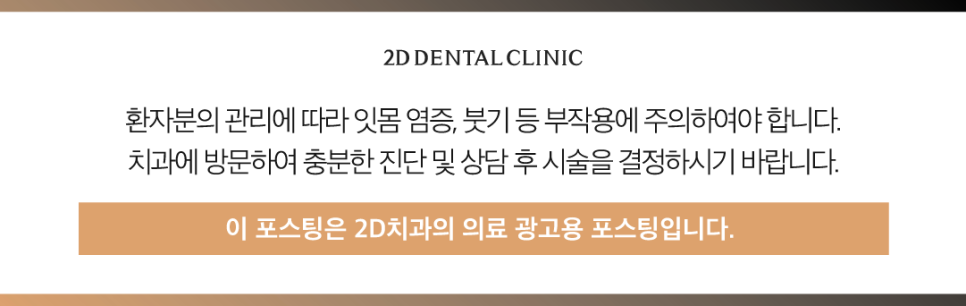 창원무삭제라미네이트 치과치아미백 어떤 방법이 좋을지 고민될 때 관련 이미지 12