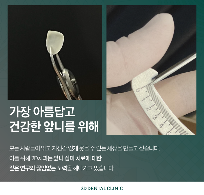 얇고 튼튼한 강남무삭제라미네이트 블랙필름 관련 이미지 9