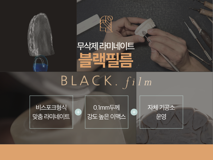 마취 필요 없는 블랙필름 무삭제라미네이트가격, 장점, 특징 관련 이미지 3