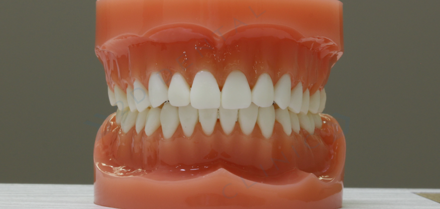 와,앞니 부분교정?!이라고?! 관련 이미지 6