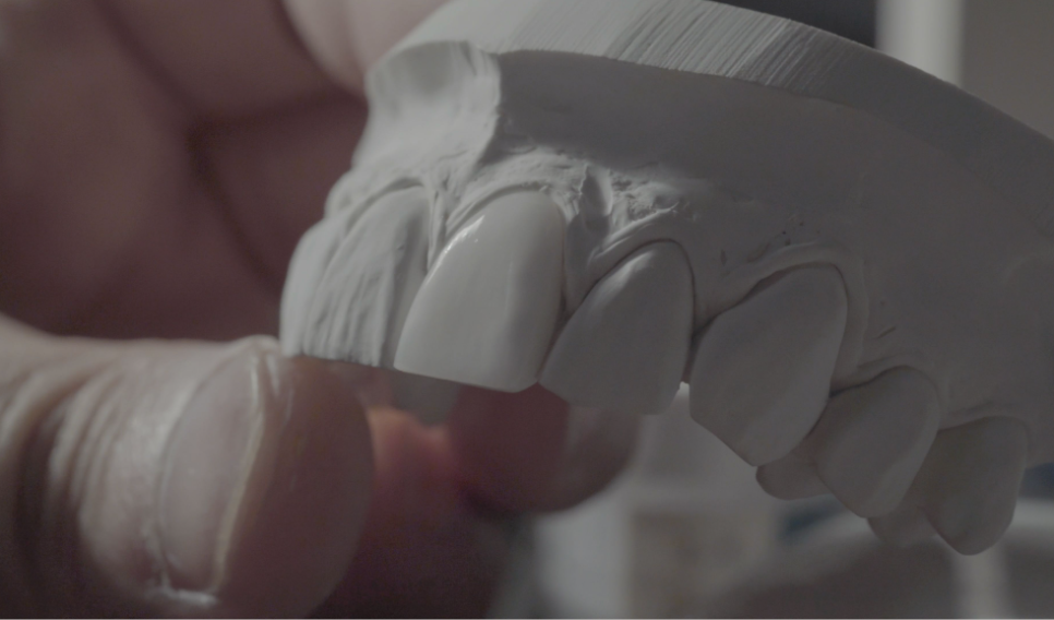 무삭제 라미네이트잘하는곳 잘 찾는 법! 관련 이미지 6