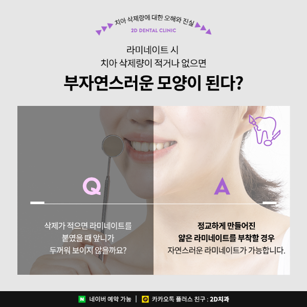 "다시 복구 못해요" 앞니라미네이트 치아 삭제량이 중요한 이유 관련 이미지 3