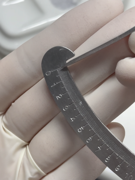 앞니치아마모증 무삭제라미네이트 블랙필름으로 치아고민해결 관련 이미지 9