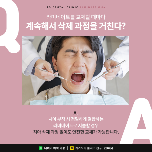 라미네이트 시술 전이라면? 이건 관련 이미지 5
