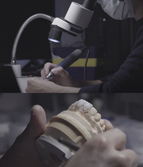 강남라미네이트병원 치아삭제 없는 무삭제치아성형 블랙필름 관련 이미지 6