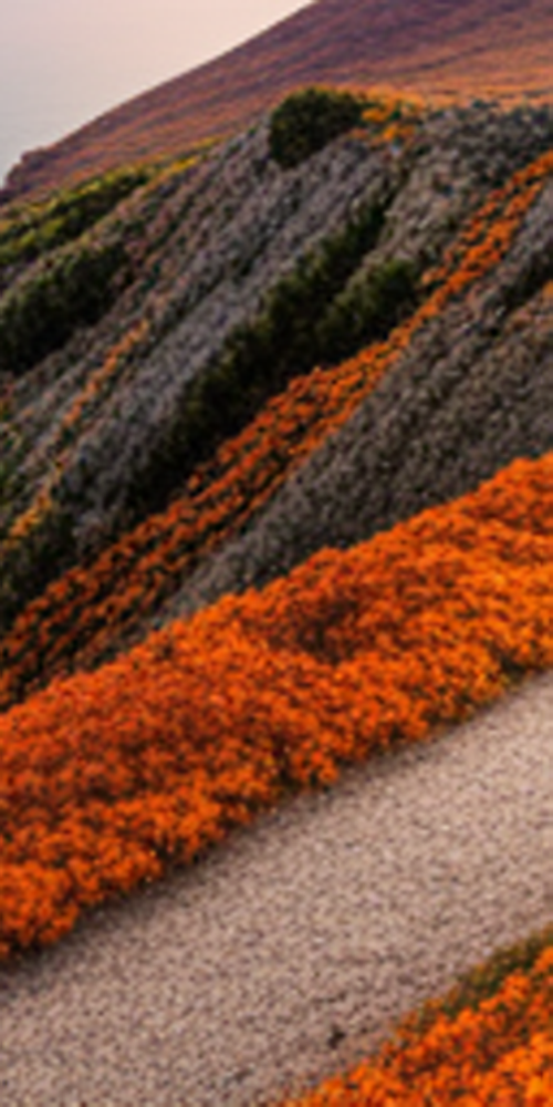 치과라미네이트 비용보다 중요한 것은? 관련 이미지 17