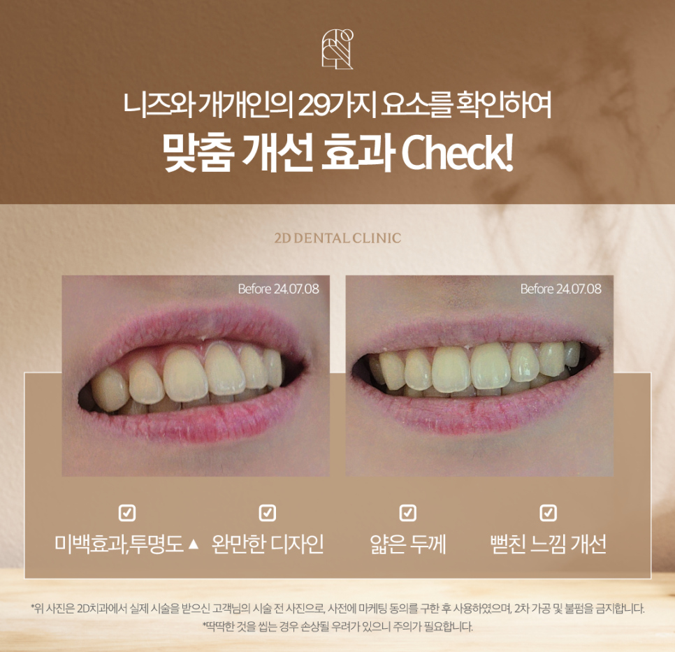 치아화이트닝 하얀이로 거듭날 수 있었던 투디 고객님의 고민은? 관련 이미지 4