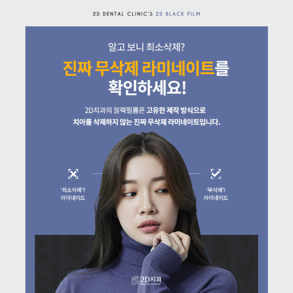 자연치 그대로 살렸다! 진짜 무삭제 라미네이트 <블랙필름> 관련 이미지 2