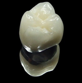 무삭제라미네이트잘하는곳 치아성형 2D치과 블랙필름 관련 이미지 11