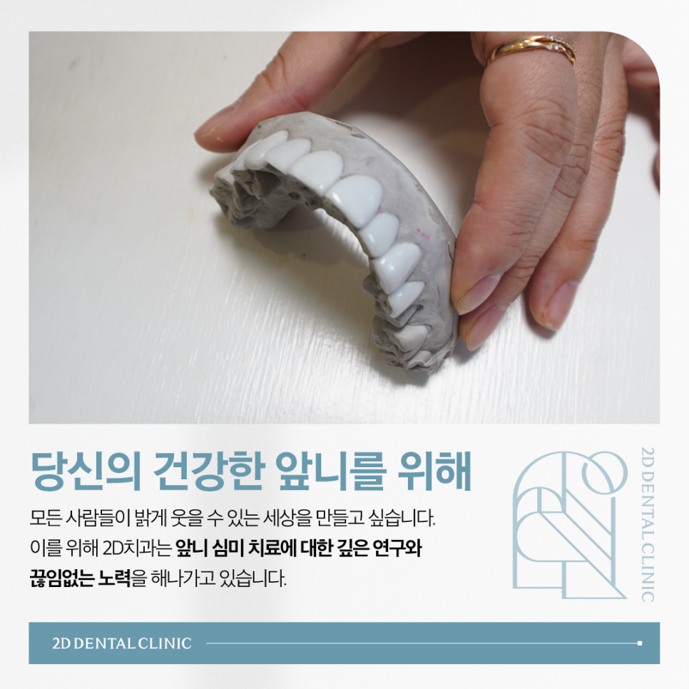 치과라미네이트 치아성형 이 손상 줄이고 심미성 높이고 관련 이미지 10