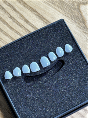 라미네이트치아삭제 고민은 그만 무삭제로 자연치보존하는 블랙필름 관련 이미지 4