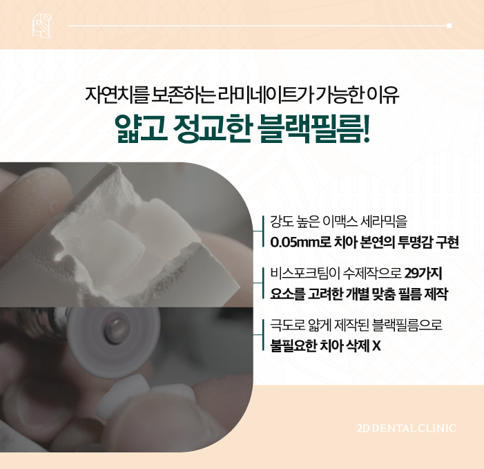 소중한 자연치 손상 없는 치아무삭제라미네이트 블랙필름 관련 이미지 5