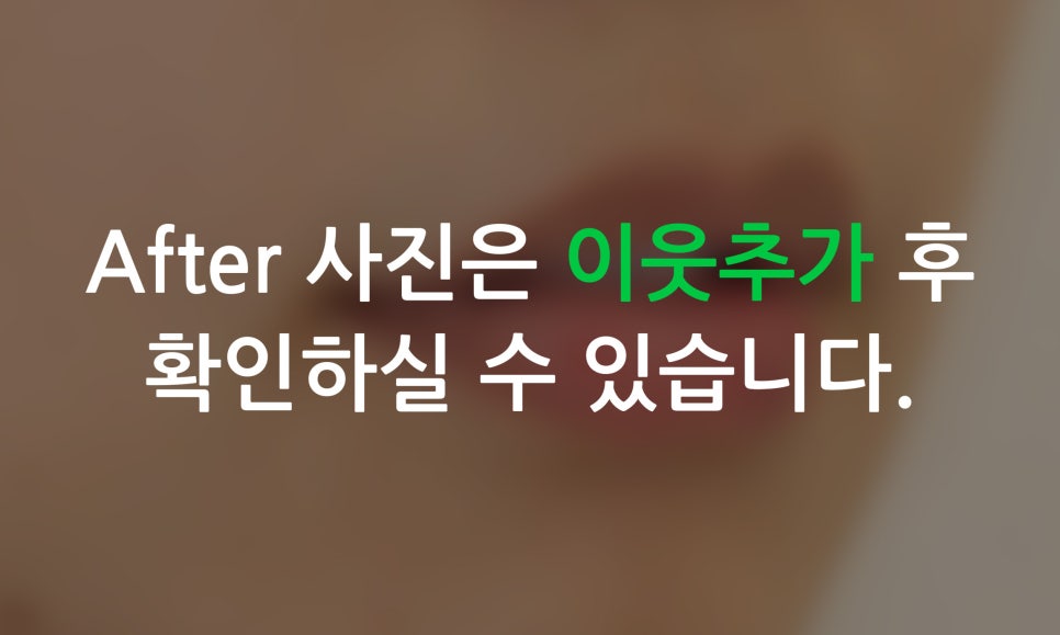 2D치과(투디치과)가 소개하는 토끼앞니 2D교정방법! 관련 이미지 7