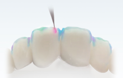 "100시간의 법칙, 블링스"란 무엇인가요? 관련 이미지 6