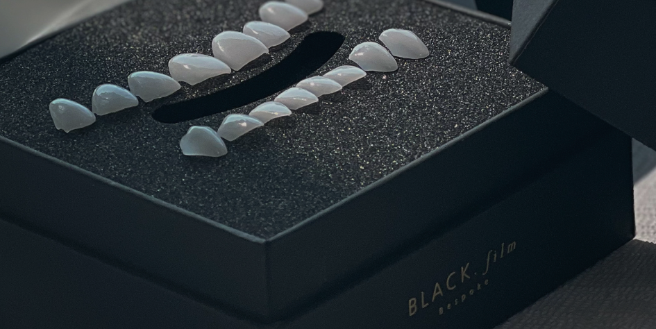 무삭제 라미네이트잘하는곳 잘 찾는 법! 관련 이미지 2