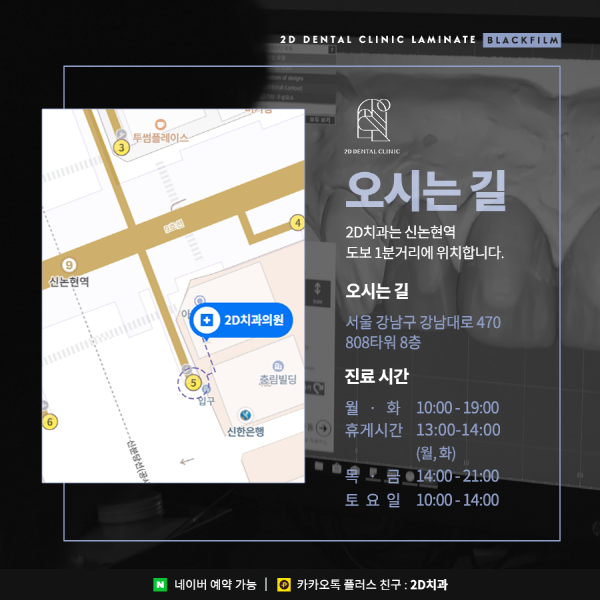 치아 삭제 없는 앞니 무삭제 라미네이트 <블랙필름> 관련 이미지 8