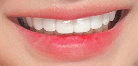 무삭제라미네이트 블랙필름의 장점과 사후관리 관련 이미지 6