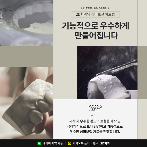 기능과 건강, 아름다움을 동시에! 2D치과의 특별한 심미보철 치료 관련 이미지 4