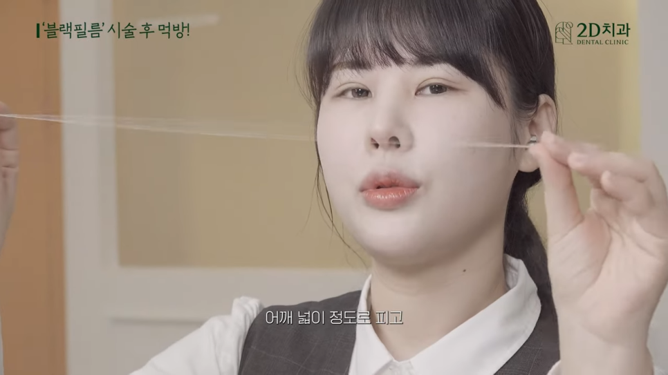 무삭제 라미네이트 블랙필름 시술 후 이런 음식도 가능? 관련 이미지 19