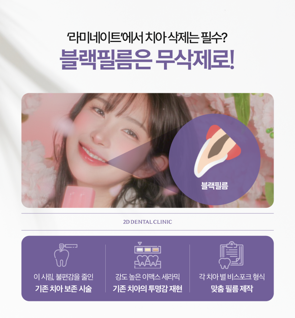 블랙필름무삭제라미네이트 치아미백후 착색되지는 않을까? 관련 이미지 3