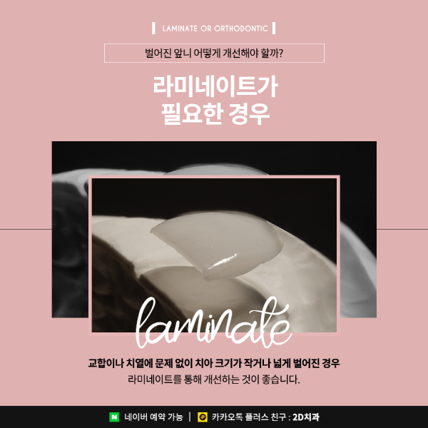 벌어진앞니는 라미네이트? 치아교정? 이렇게 선택하세요 관련 이미지 4