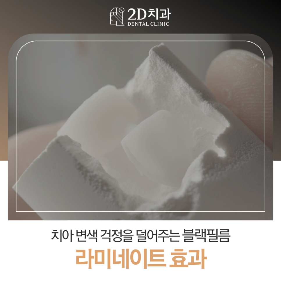 블랙필름 무삭제라미네이트로 앞니파절 치아미백 걱정 없어요 관련 이미지 1