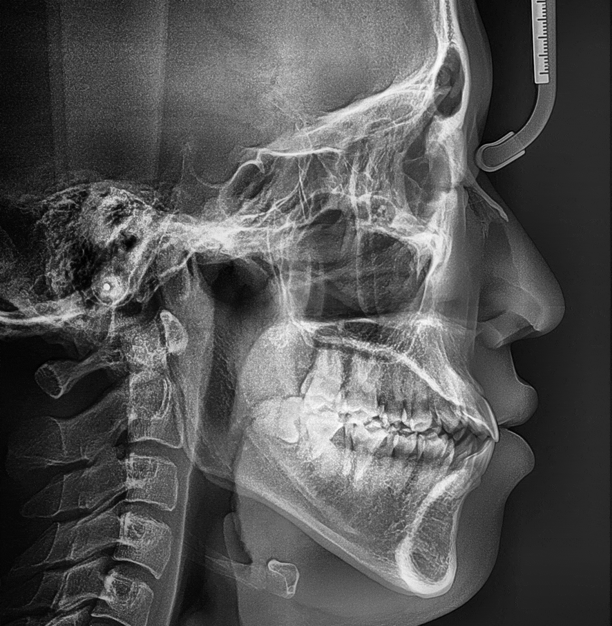 강남역치과 [투디치과] 최대리님 교정진행중/직원들도 믿고 교정해요! 관련 이미지 3