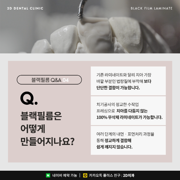 무삭제 라미네이트 <블랙필름> 이 궁금하다면? 관련 이미지 6