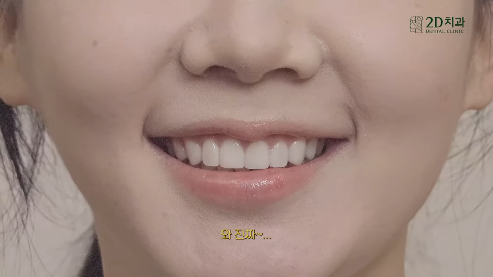 [블랙필름의 오해와 진실] #2 블랙필름 시술 후 관리 방법! 관련 이미지 6