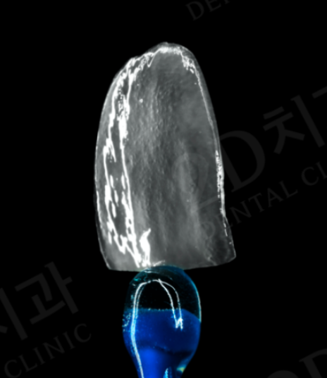 무삭제라미네이트 오해의 진실 관련 이미지 8