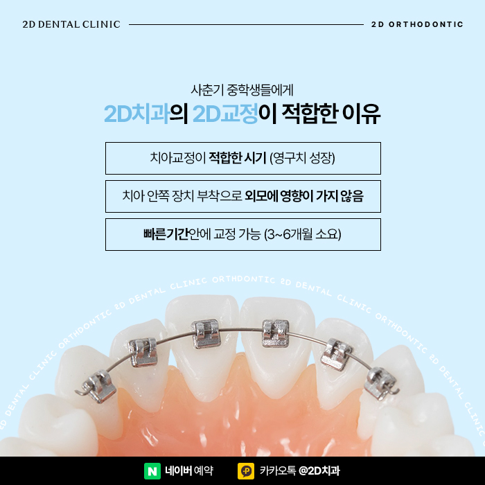 중학생치아교정 사춘기 걱정된다면 투디교정으로 신논현치과 관련 이미지 3