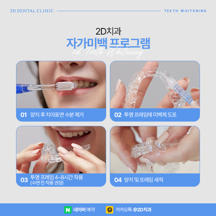 치과 치아미백치료 효과, 유지기간은? 강남 누런니 개선 관련 이미지 6