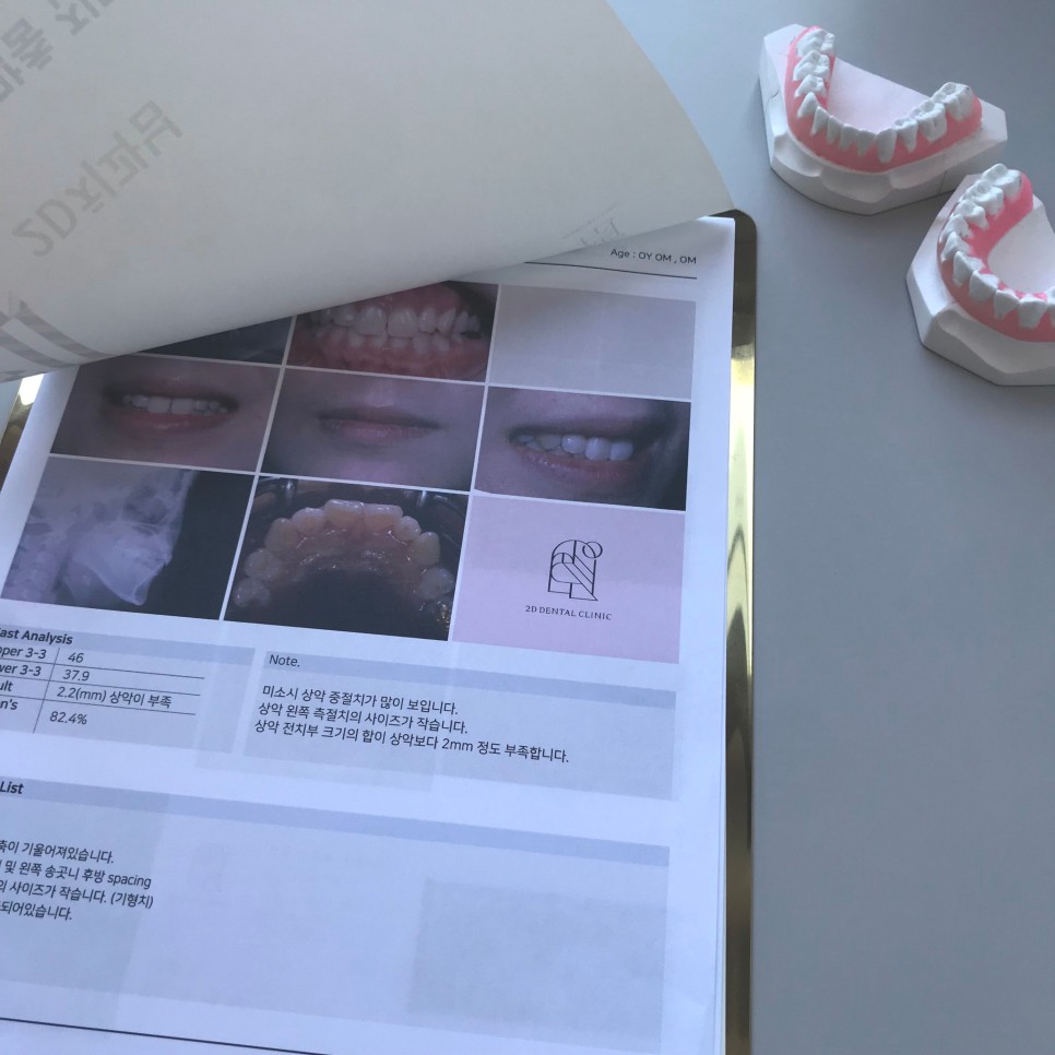 토끼이빨 치아교정 치료 사례 관련 이미지 2