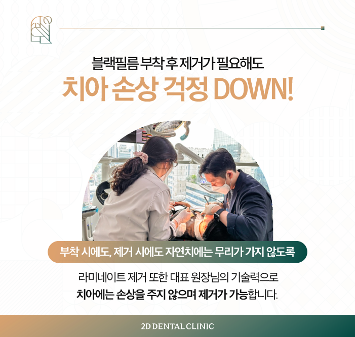 무삭제라미네이트부작용 치과라미네이트, A/S는? 관련 이미지 7