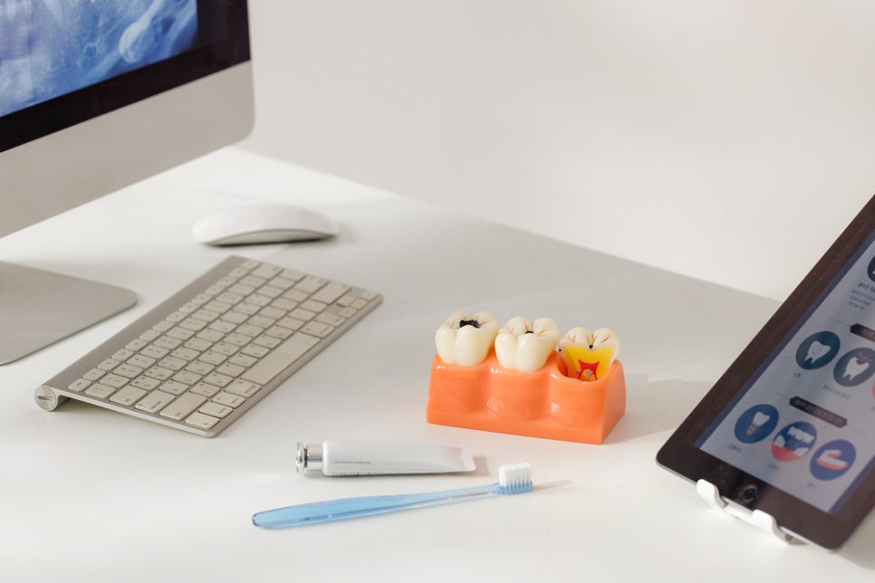 라미네이트과정 어떤 방식으로 시술이 진행될까? 관련 이미지 2