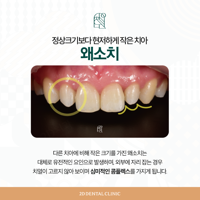 무삭제라미네이트비용 블랙필름 왜소치 고민 해결! 관련 이미지 3