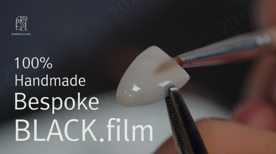 앞니깨짐 라미네이트로 자연스럽게! 관련 이미지 13