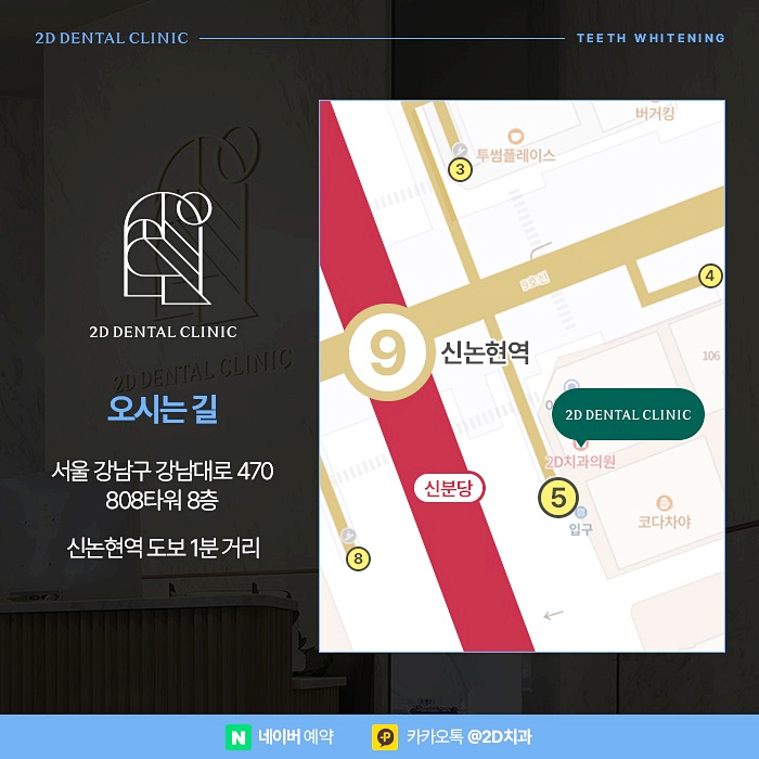 치과 치아미백치료 효과, 유지기간은? 강남 누런니 개선 관련 이미지 10