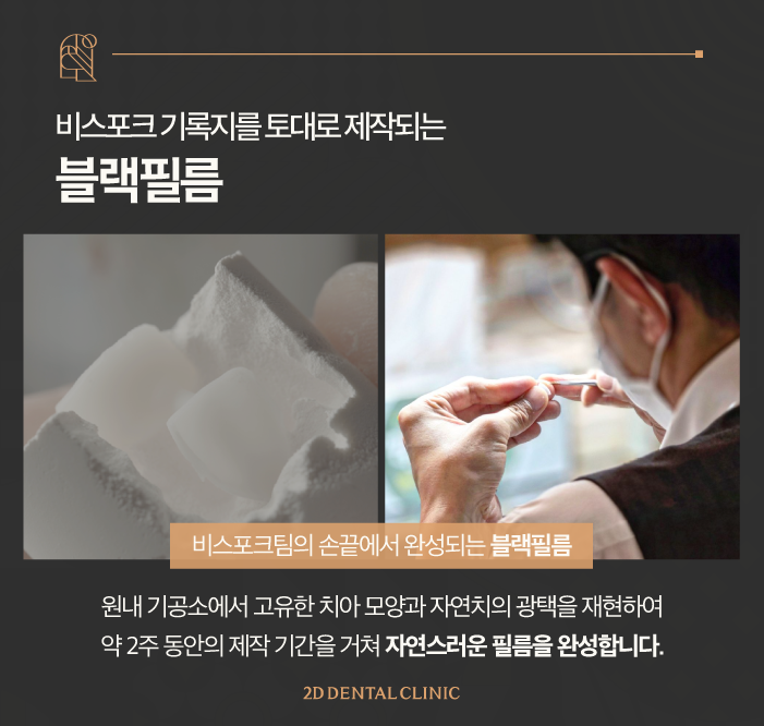 무삭제라미네이트후기 투디치과 블랙필름 탄생 과정 관련 이미지 6