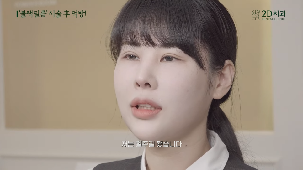 무삭제 라미네이트 블랙필름 시술 후 이런 음식도 가능? 관련 이미지 3