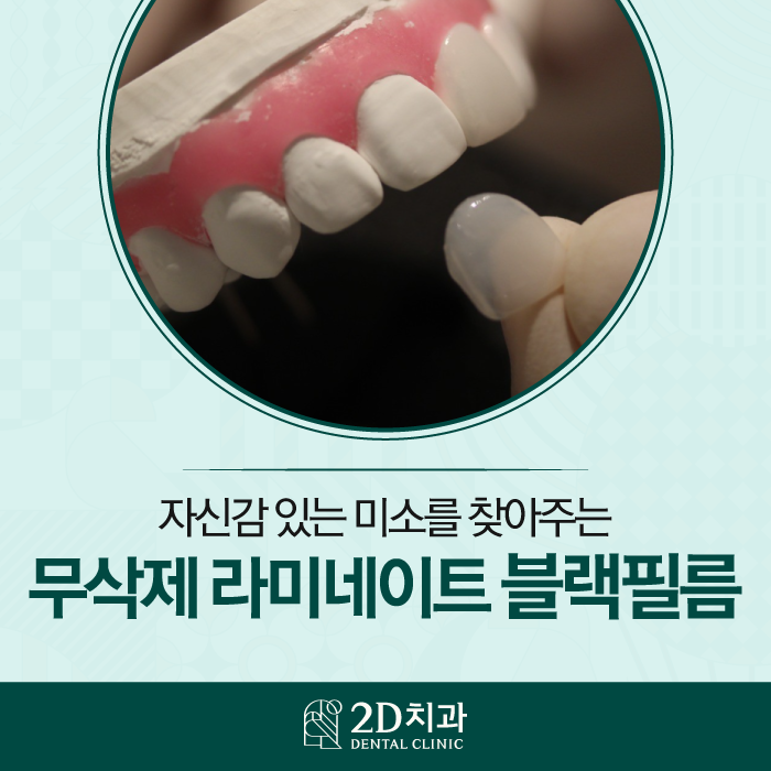 이 시림 없이 무삭제 라미네이트잘하는곳 관련 이미지 1